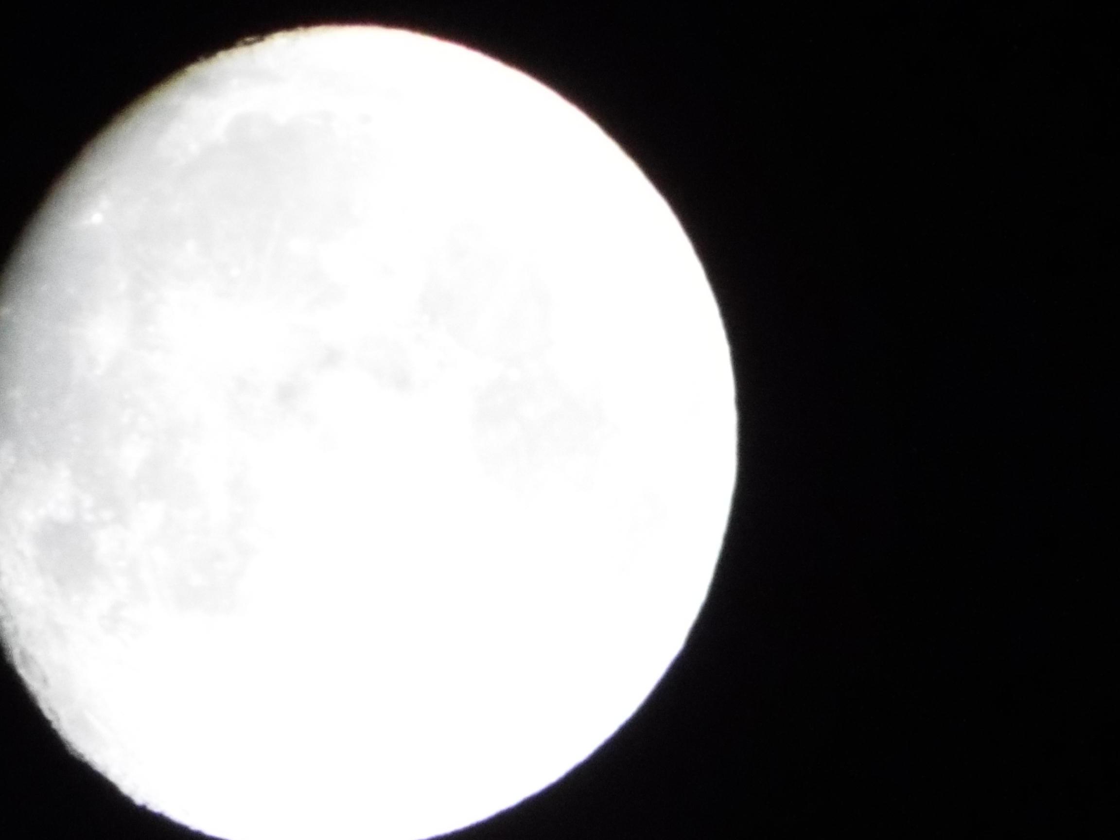 ��������X